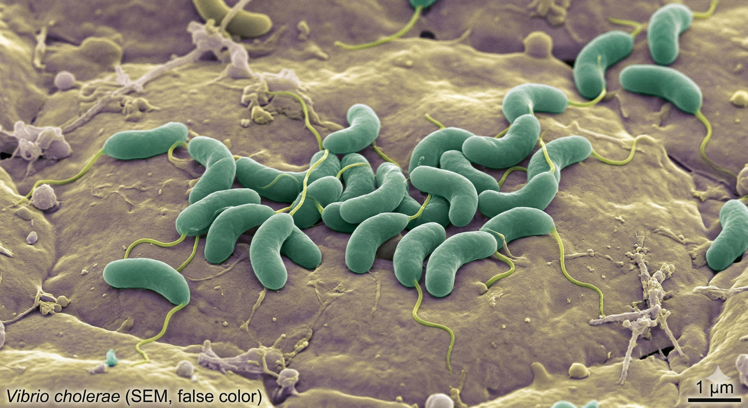Building the National Diagnostic Capacity for Vibrio Cholerae, and Klebsiella Pneumoniae Rapid and Molecular Diagnostics in Uganda